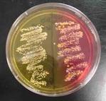 Mannitol Salt Agar with Pathogens 9left) and Normal Flora (right)