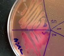 MacConkey's Agar with Lac- Salmonella on top and Lac+ E. coli on bottom