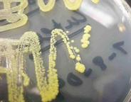 Micrococcus luteus, a Gram positive microbe isolation streak plated on TSY agar